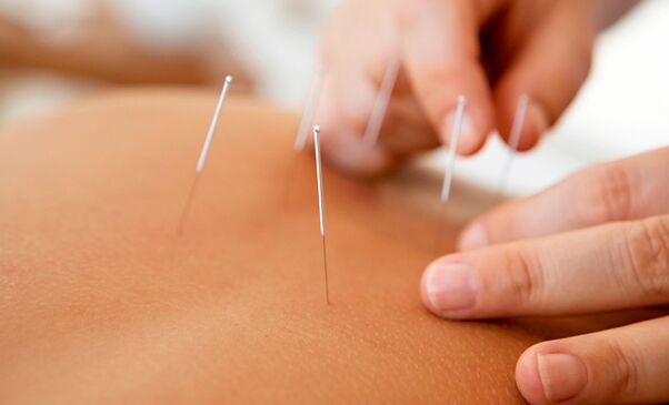 akupunktura na zwiększenie potencji